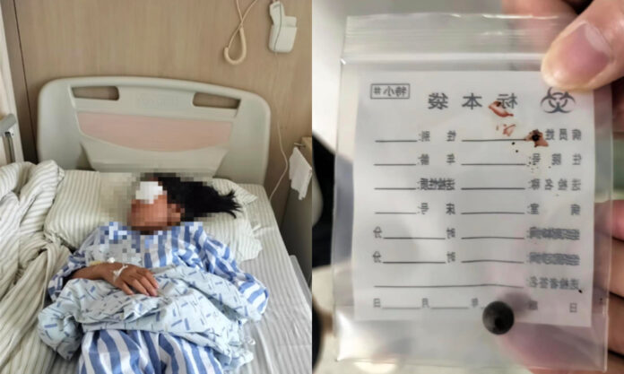 The Nanjinger - Girl Blinded by Slingshot Fired by Boy in Suqian; ¥200,000 in Compensation