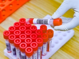 The Nanjinger - Is there an End to all these Nucleic Acid tests? For some, Maybe