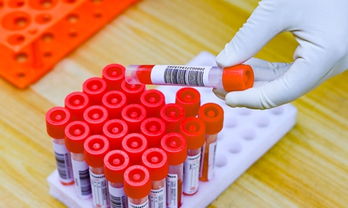 The Nanjinger - Is there an End to all these Nucleic Acid tests? For some, Maybe