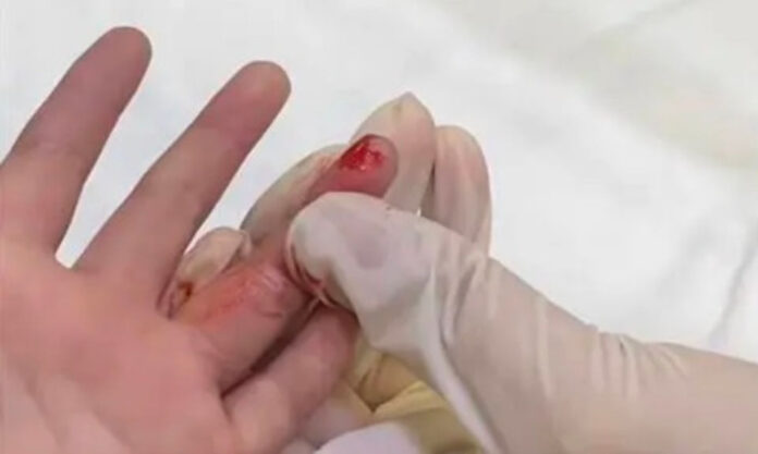 The Nanjinger - Xuzhou Medics Take Blood Sample with Another’s Blood Still on their Gloves