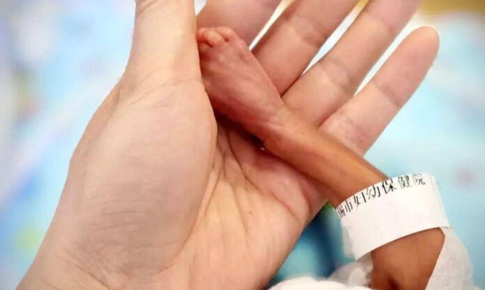 The Nanjinger - Happy Birthday to Baby Born Premature at 23 Weeks in Wuxi Weighing 710 Grams