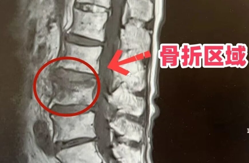 The Nanjinger - 104 Year Old Man Walks out of Hospital Hours after Spine Surgery in Nantong