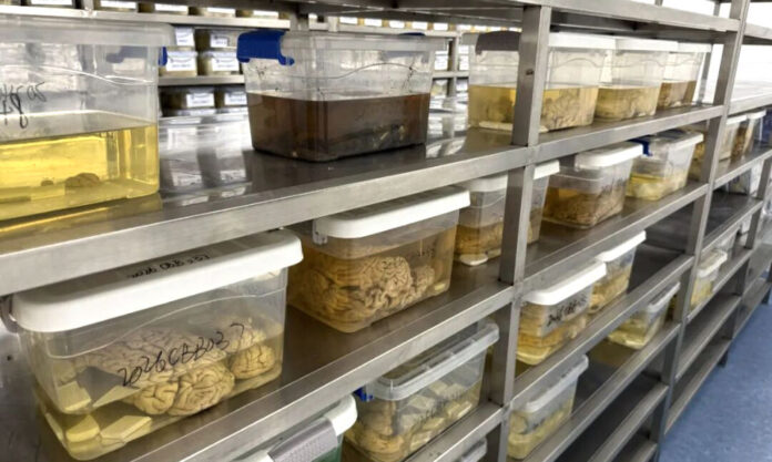 The Nanjinger - China’s Brain Banks Need Donors as Human Tissue Reveals Dementia Clues