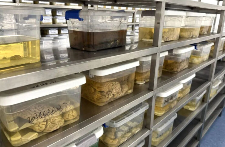 The Nanjinger - China’s Brain Banks Need Donors as Human Tissue Reveals Dementia Clues